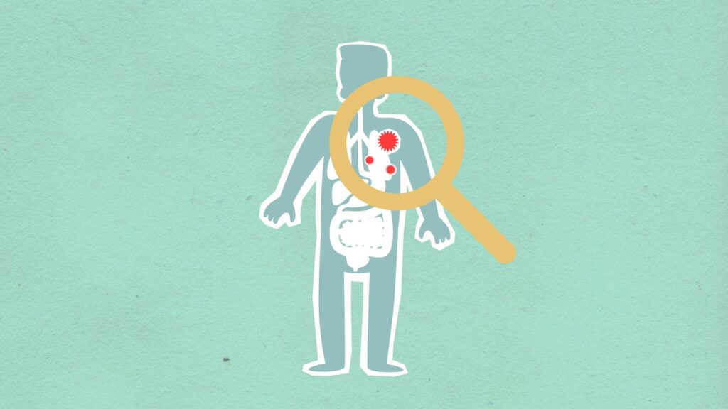 Infections respiratoires
