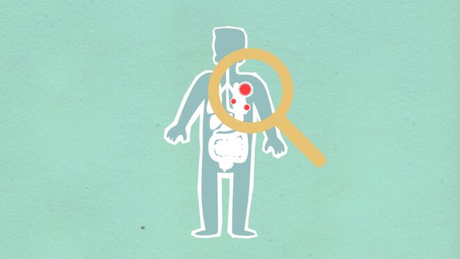Infections respiratoires