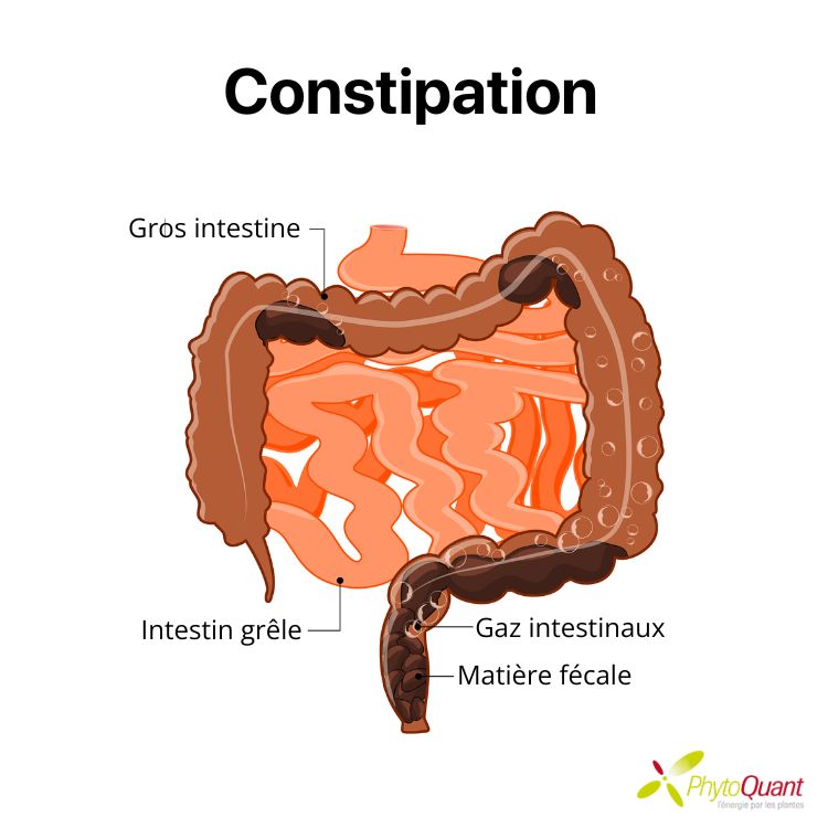 ce que c'est la constipation expliquée par PhytoQuant