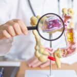 Je souffre du syndrome de l’Intestin Irritable : que me conseillez-vous ?