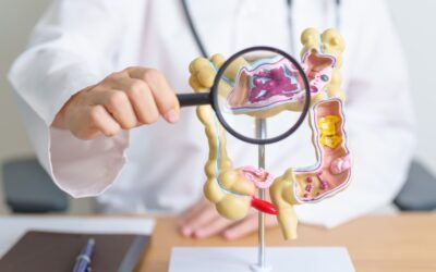 Je souffre du syndrome de l’Intestin Irritable : que me conseillez-vous ?