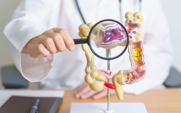 Je souffre du syndrome de l’Intestin Irritable : que me conseillez-vous ?