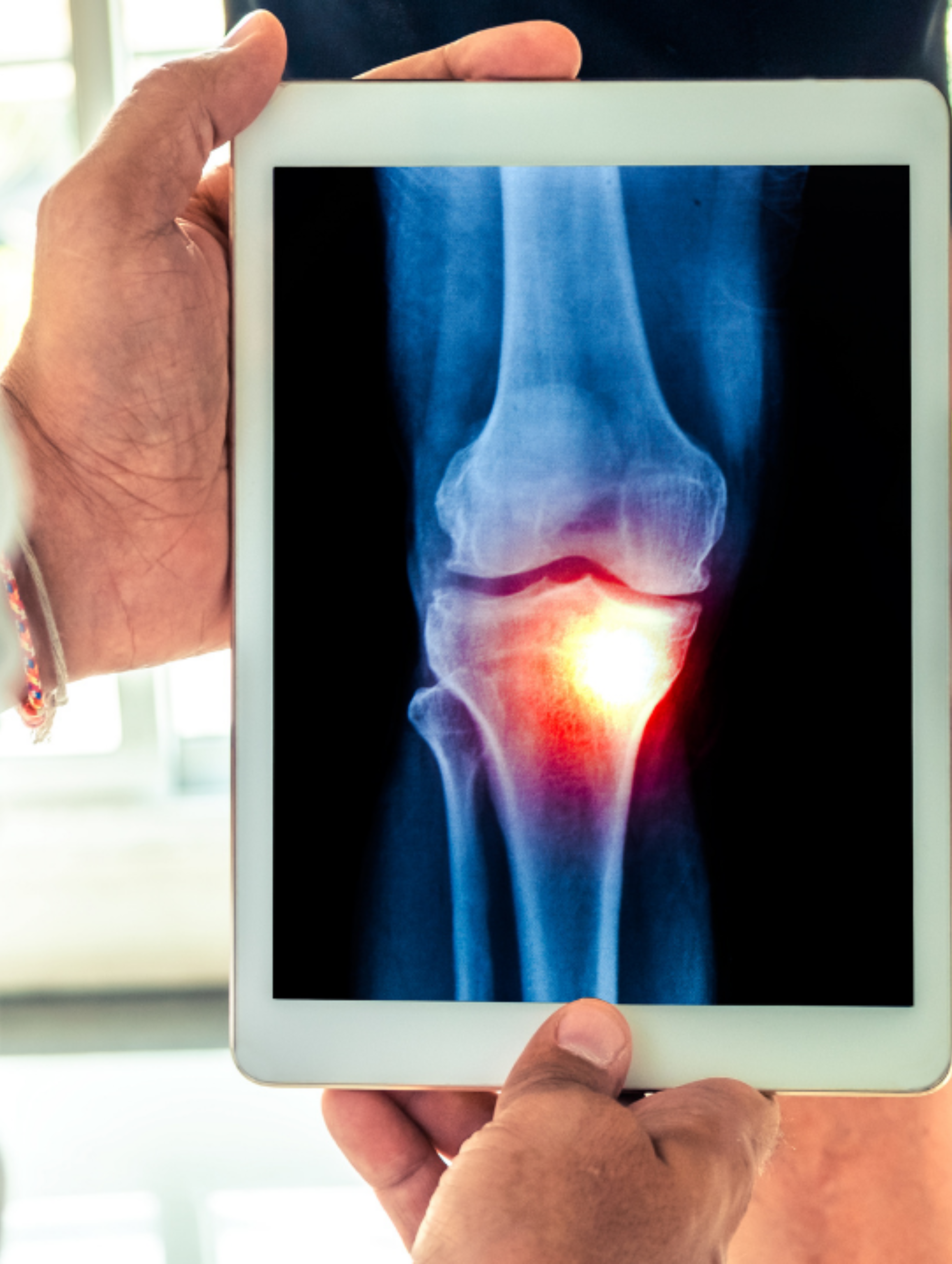 Arthrose ou arthrite : comment faire la différence ?