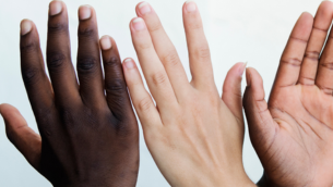 Carnation quelle protection solaire pour ma peau