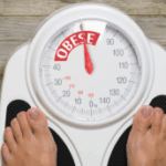 surpoids obesite et jambes lourdes