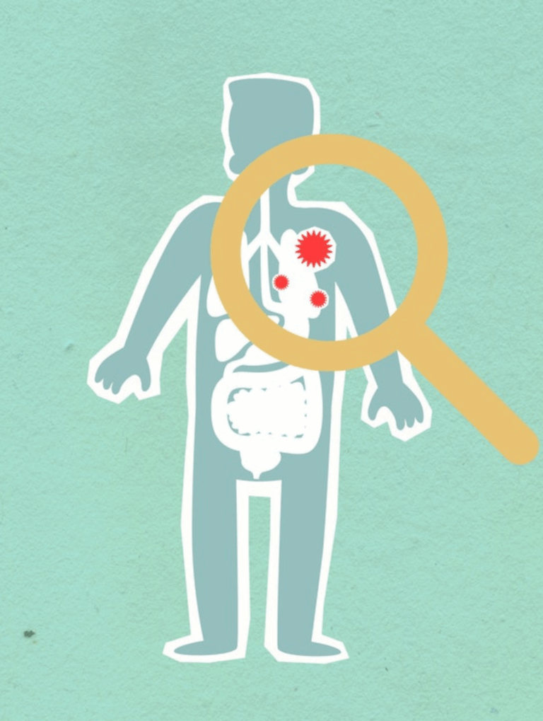 Toux persistantes et difficultés respiratoires après une infection ORL-small