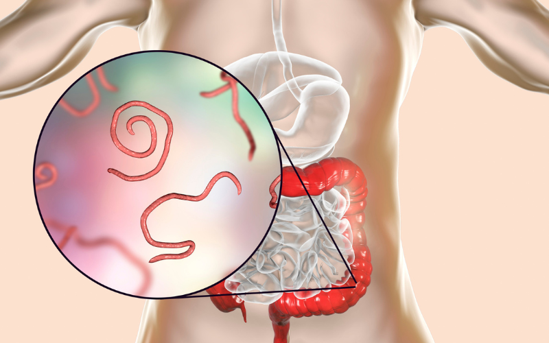 parasites volent des nutriments, diminuent l'immunité, créent une inflammation chronique