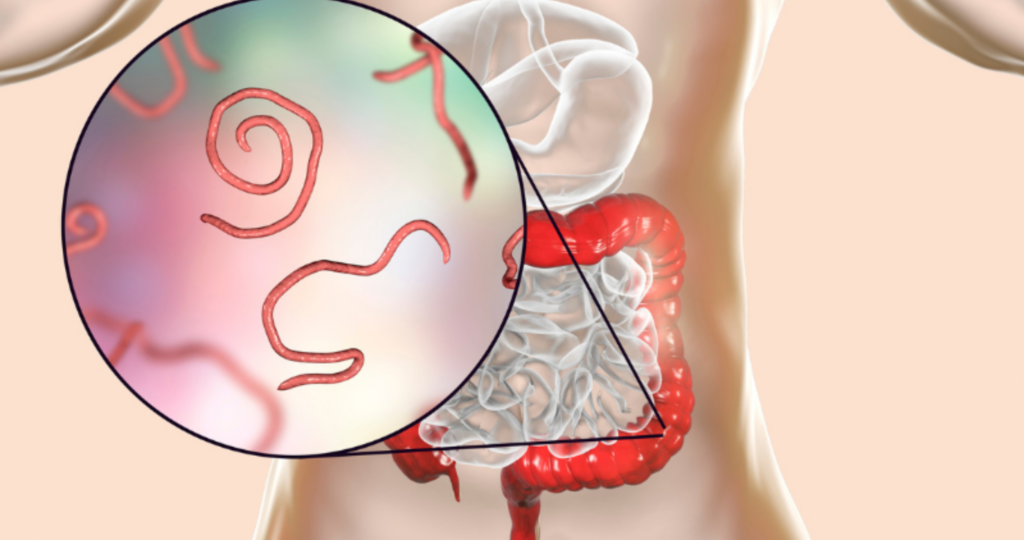 Les parasites : des hôtes silencieux pendant des années​