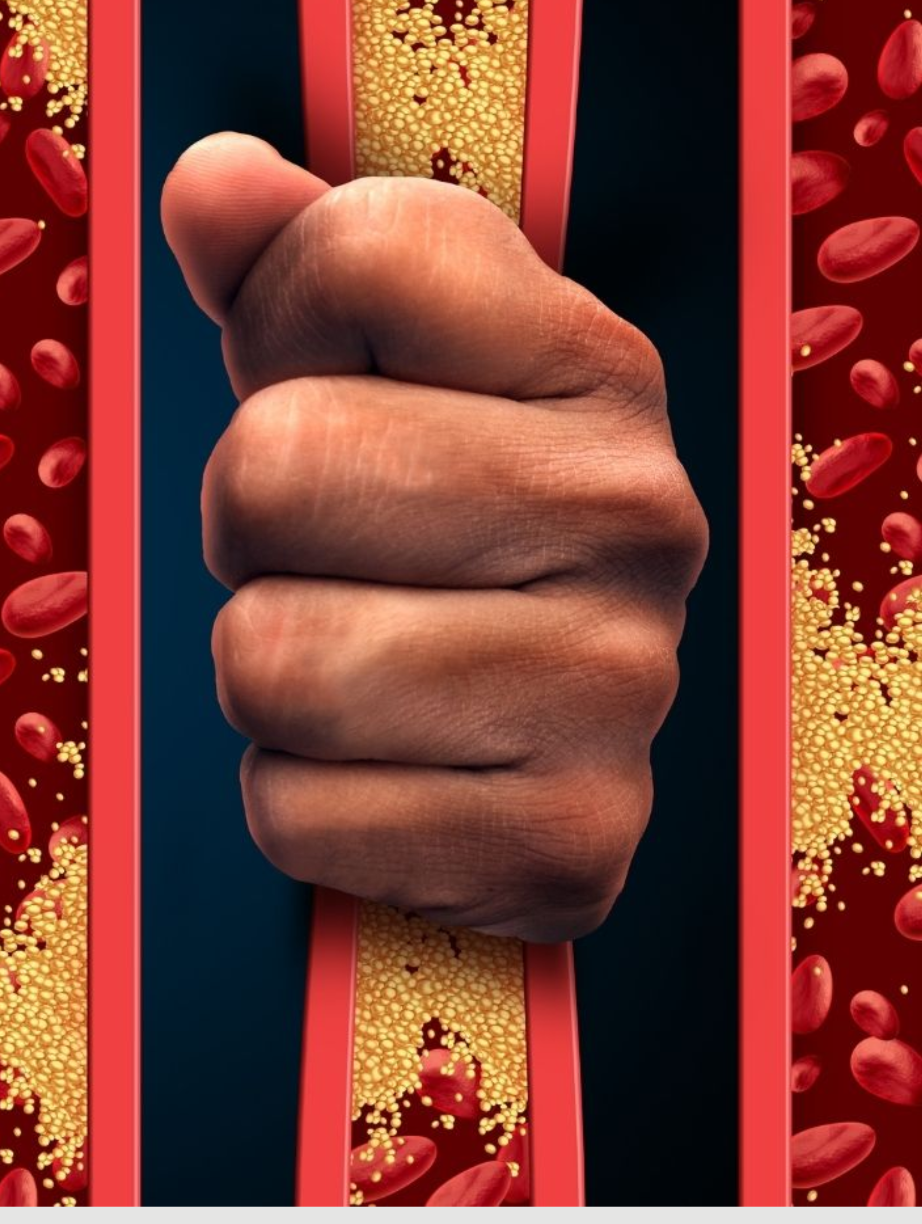 Cholestérol : Ami ou Ennemi ?