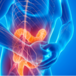 Un inconfort intestinal Un estomac lourd, des ballonnements, parfois des éructations, des gaz, des flatulences, des bruits intestinaux