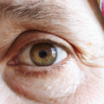 oxydation due au stress