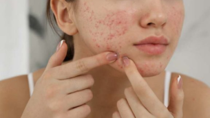 zinc et sante de la peau