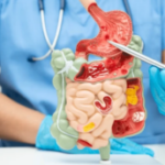 impaction fecale complications constipation