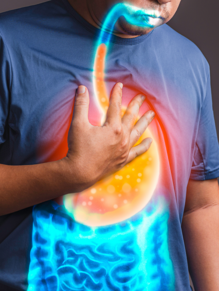 Acidité d'estomac reflux
